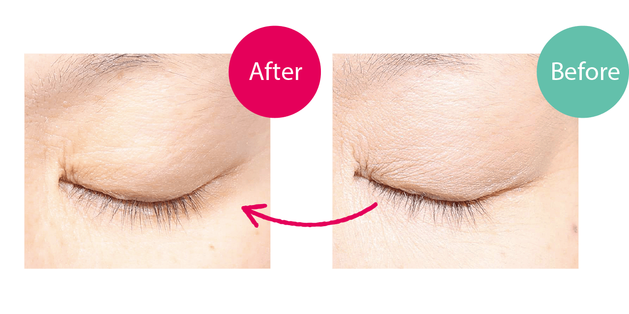 静岡市 由子様　43歳